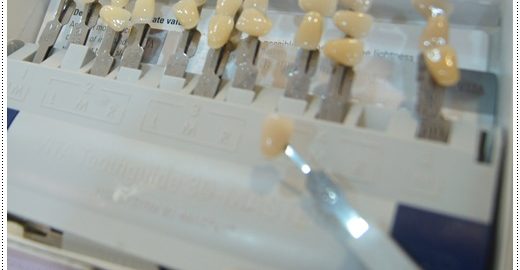 台北冷光牙齒美白推薦ptt 彙整 心情部落